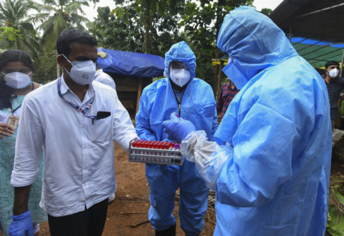 OBSH ngre alarmin për virusin me vdekshmëri deri në 75 përqind