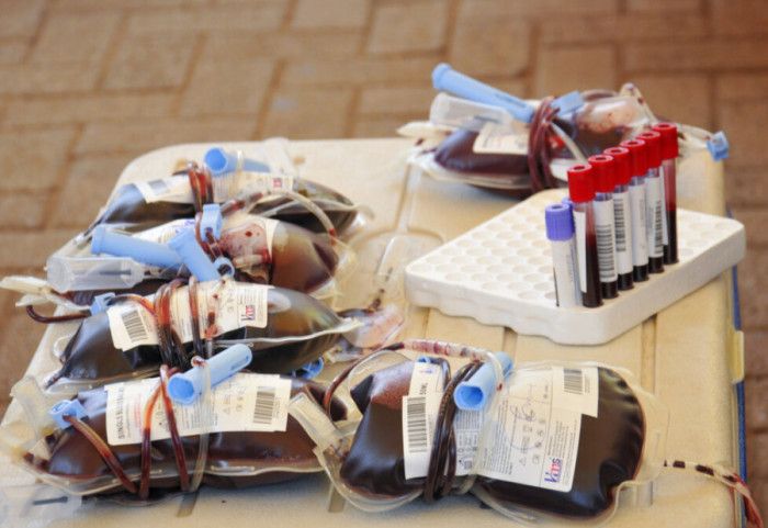 Çfarë është "gjaku i artë", që rrjedh në venat e vetëm 50 njerëzve në botë?