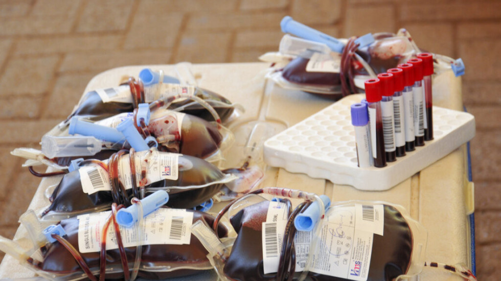 Çfarë është "gjaku i artë", që rrjedh në venat e vetëm 50 njerëzve në botë?