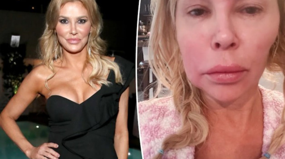 “Më shpërtheu implanti i gjoksit”, ylli televiziv zbulon arsyet e shpërfytyrimit