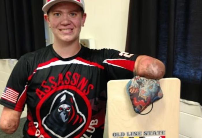 Arrestohet vrasësi pa duar dhe pa këmbë