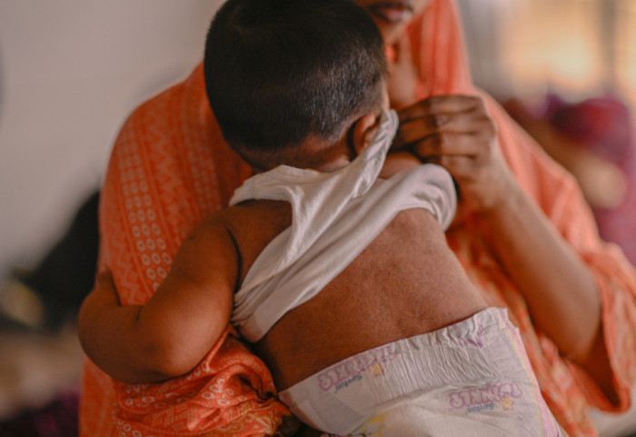 Prag epidemie, mbi 100 viktima nga fruthi në Bangladesh