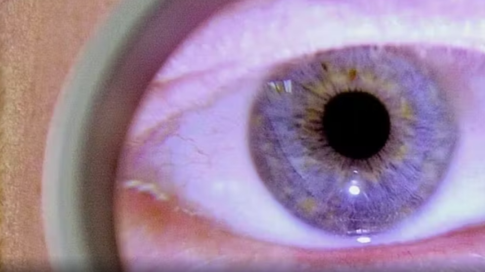 Krijohet lentja e kontaktit “smart”, monitoron dhe kuron sëmundjet e syrit