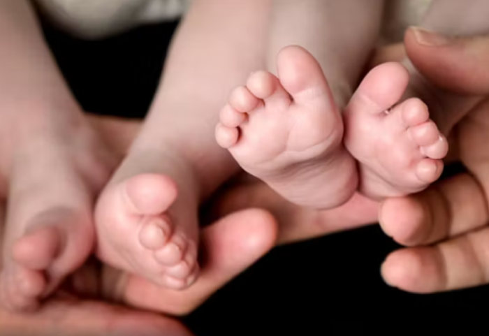 E rrallë  në Kolumbi, konfirmohen binjakët me baballarë të ndryshëm