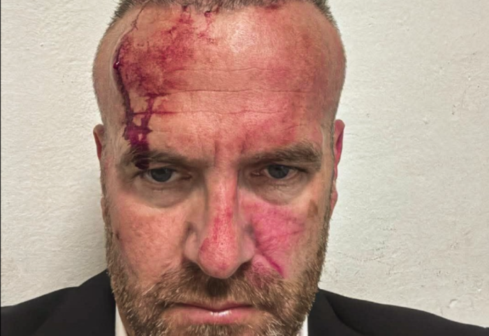 Dhuna ndaj kreut të degës së VV, policia arreston 2 persona, Sami Lushtaku nuk paraqitet