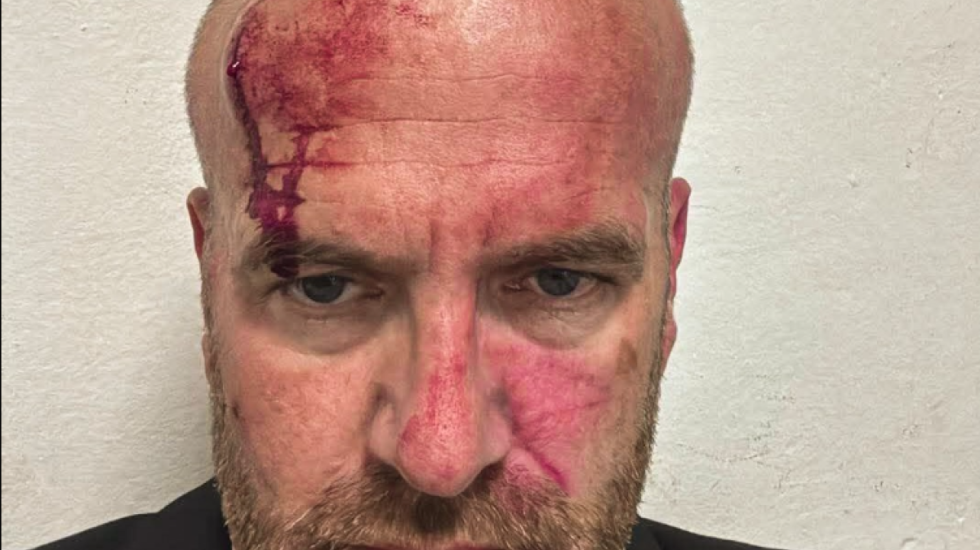 Dhuna ndaj kreut të degës së VV, policia arreston 2 persona, Sami Lushtaku nuk paraqitet